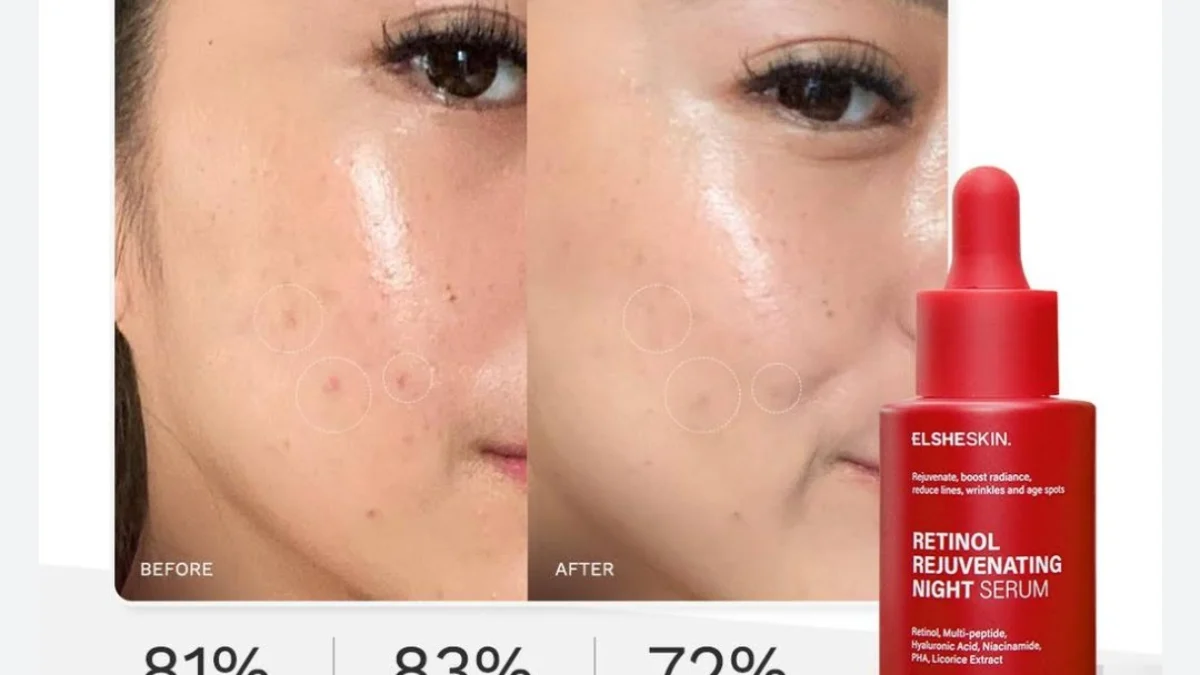 Bolehkah Pakai Retinol Tiap Hari?