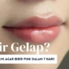 Bibir Gelap