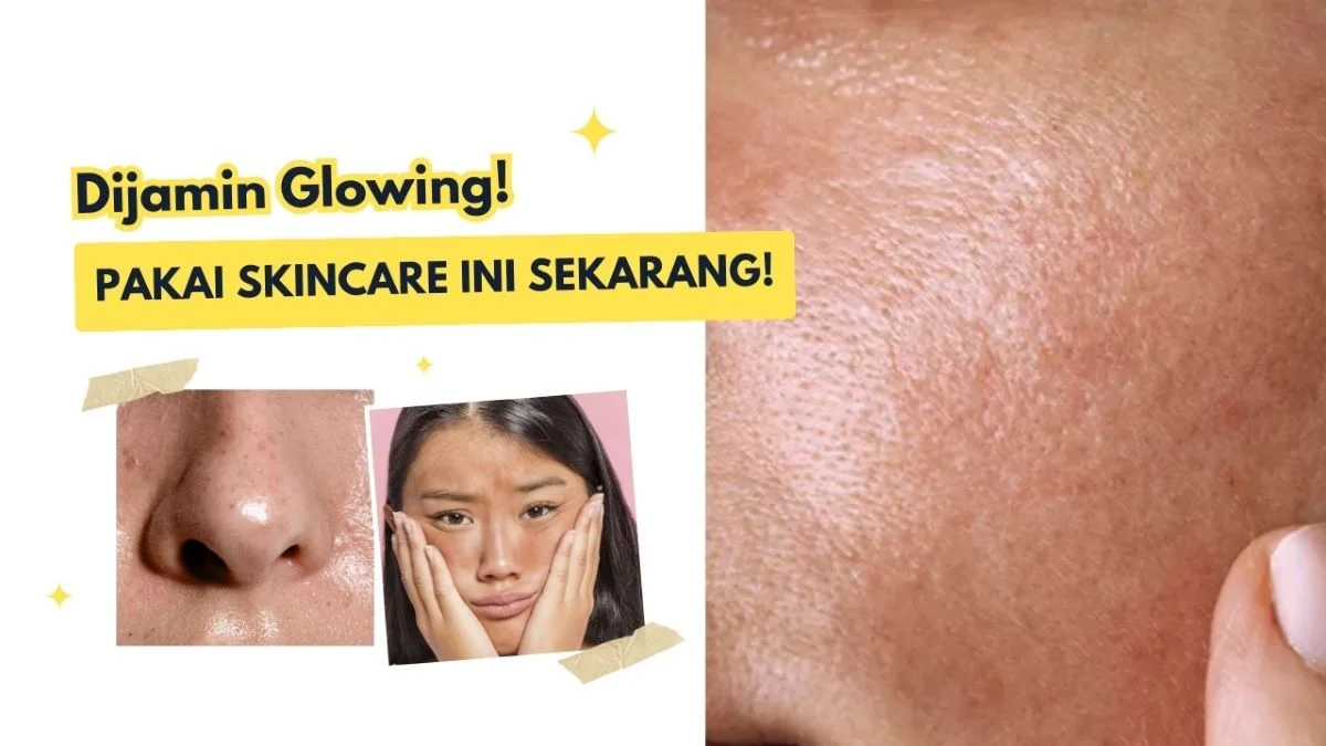 Kulit Kusam dan Berminyak