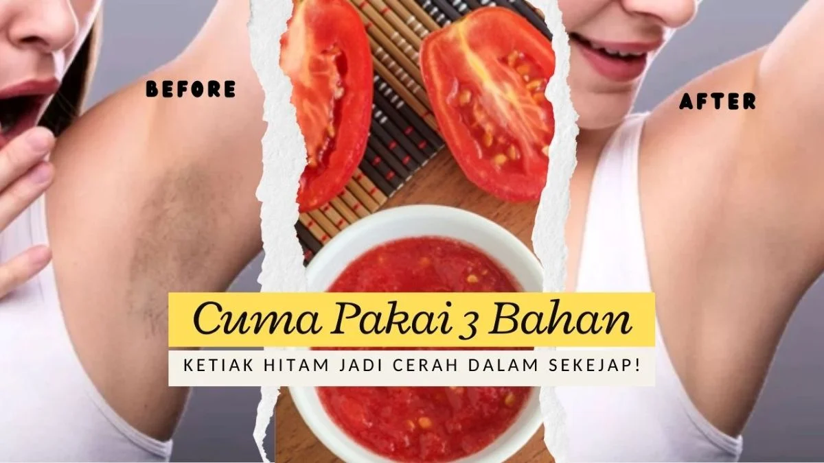 Ketiak Hitam