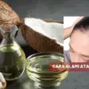 Rambut Botak