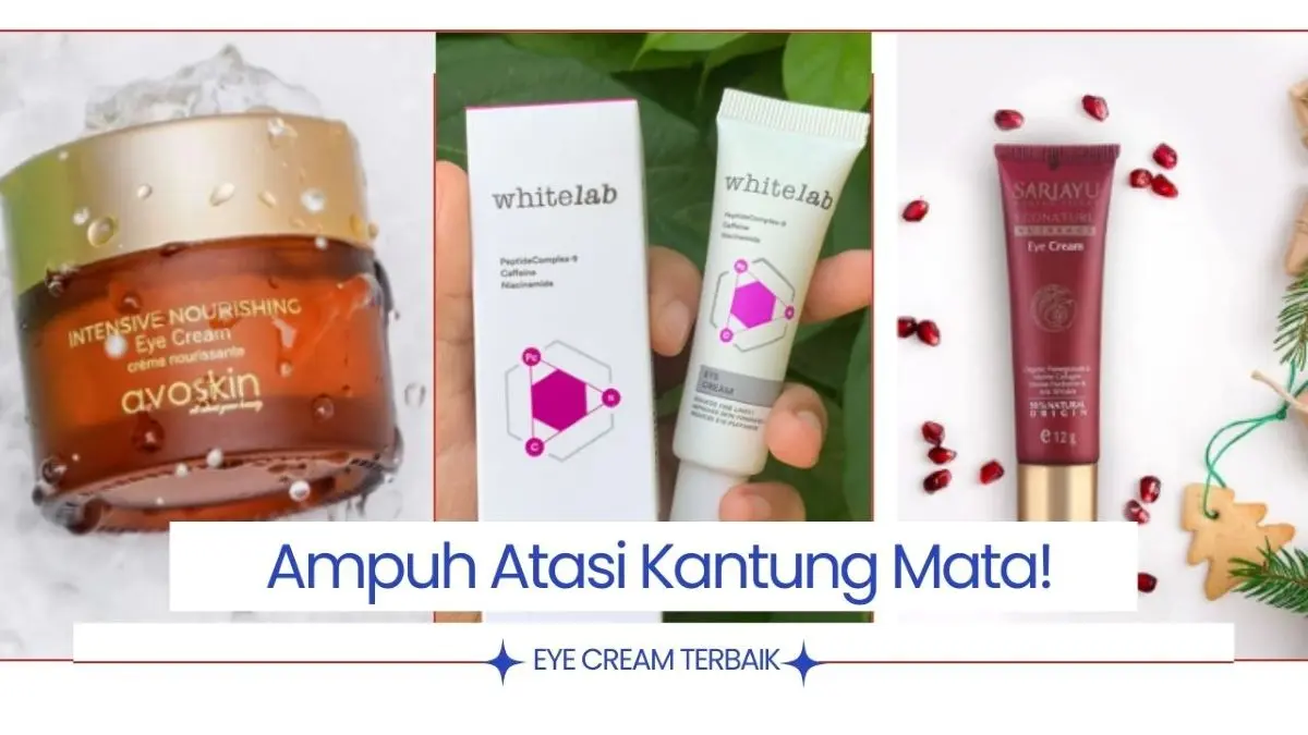 Atasi Kantung Mata