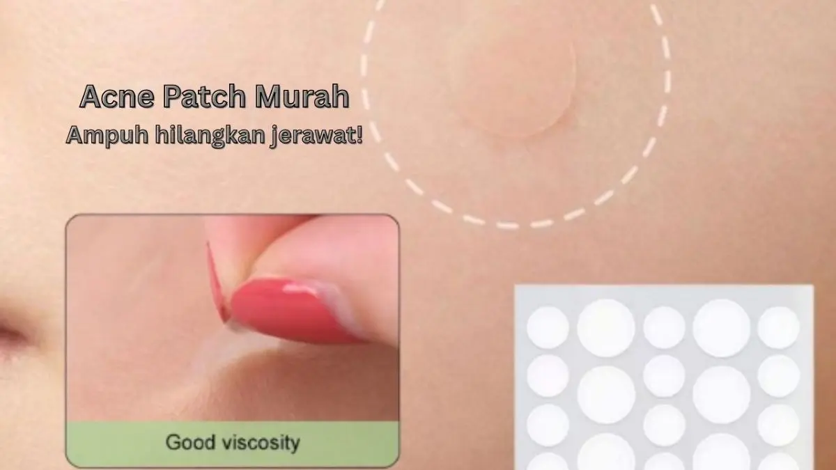 Rekomendasi Acne Patch