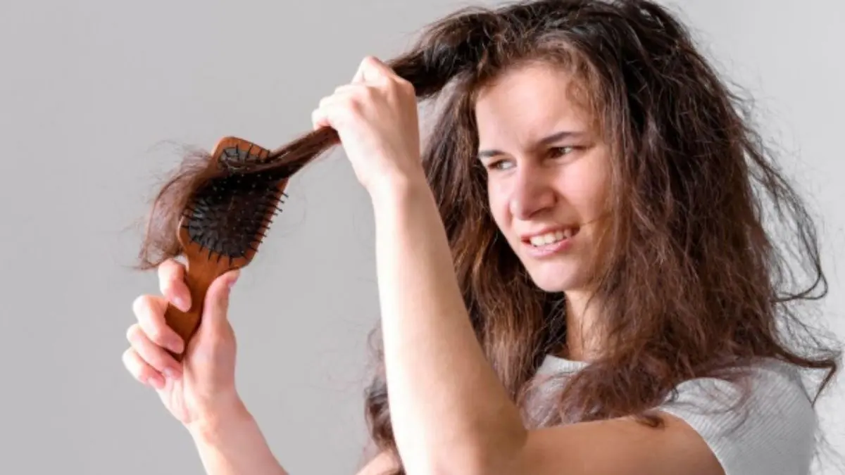 Rambut Rontok