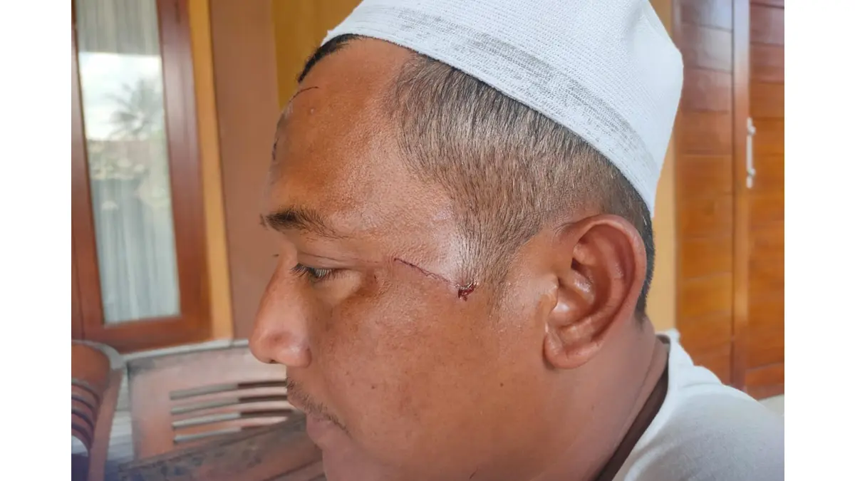 Ustaz Cucu diserang pemabuk di Tasikmalaya-Ciamis