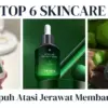Skincare untuk Kulit Berjerawat