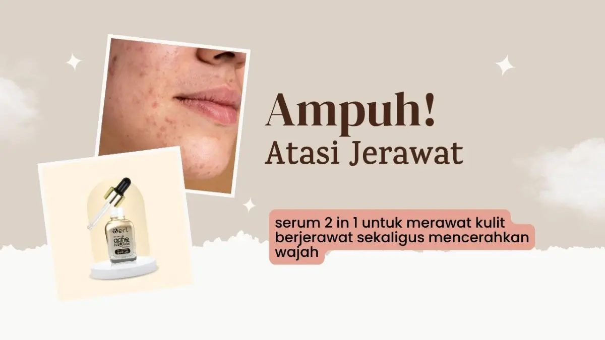 Wajah Berjerawat? Gunakan B Erl Very Berry Acne Treatment Oil Control Serum Bikin Jerawat Auto Hilang! Wajah Berjerawat