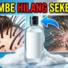 Sampo Anti Ketombe