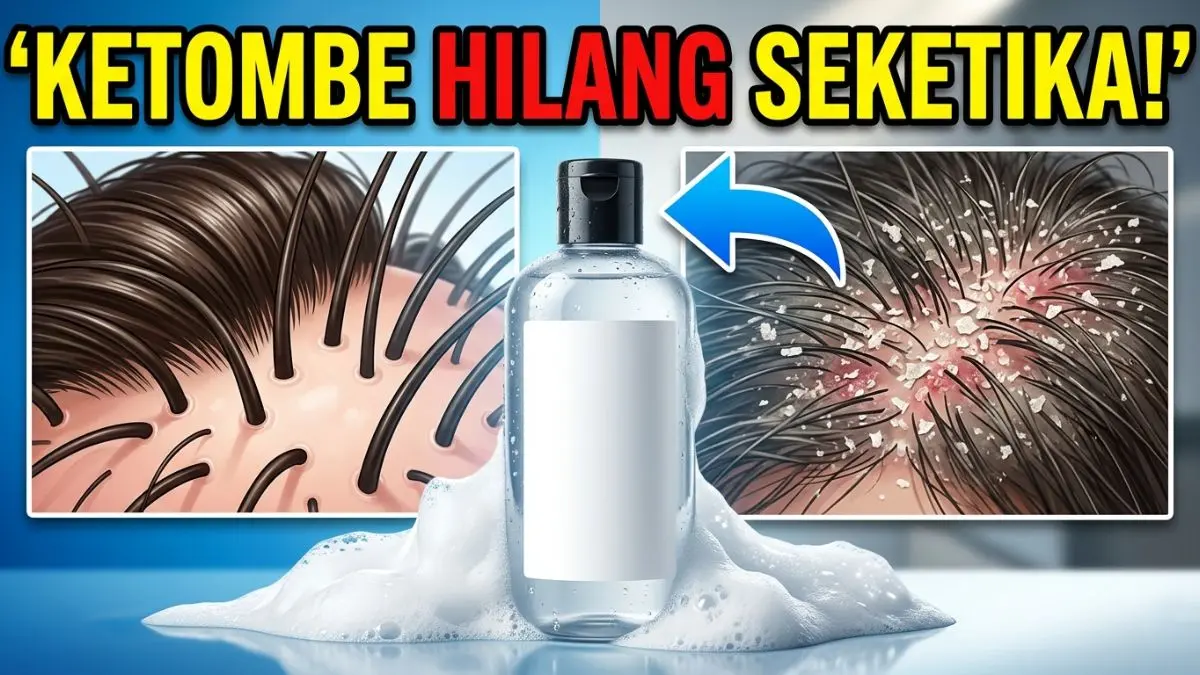 Sampo Anti Ketombe