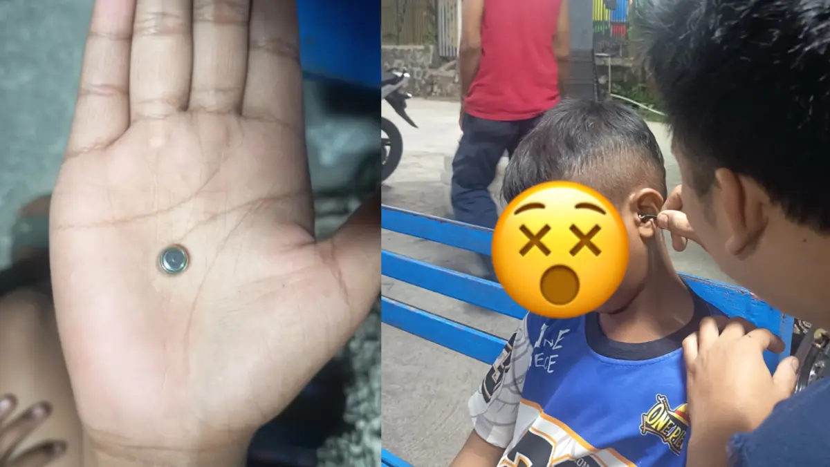 Baterai Kancing Nyangkut di Telinga Anak, Petugas Damkar Kota Tasikmalaya Mendadak jadi “Dokter THT” Damkar kota tasikmalaya