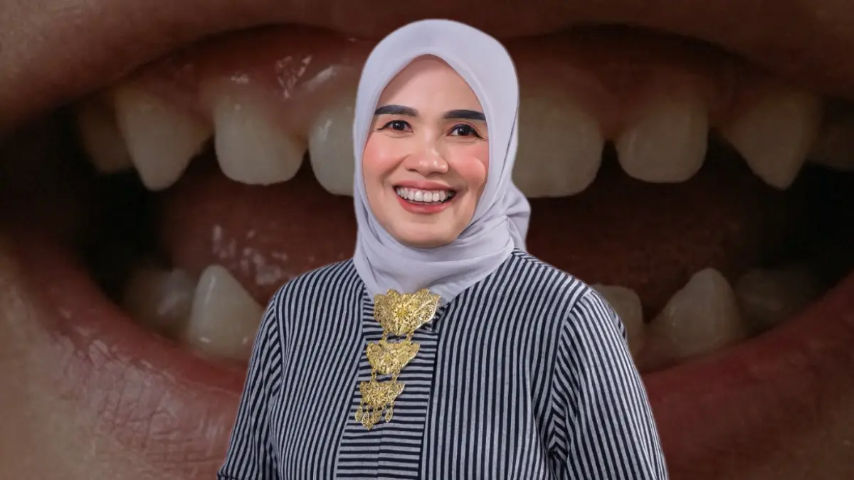 Perlu Diperhatikan Sejak Dini! RSUD Pandega Pangandaran Gaungkan Kesehatan Gigi Anak Rsud pandega pangandaran